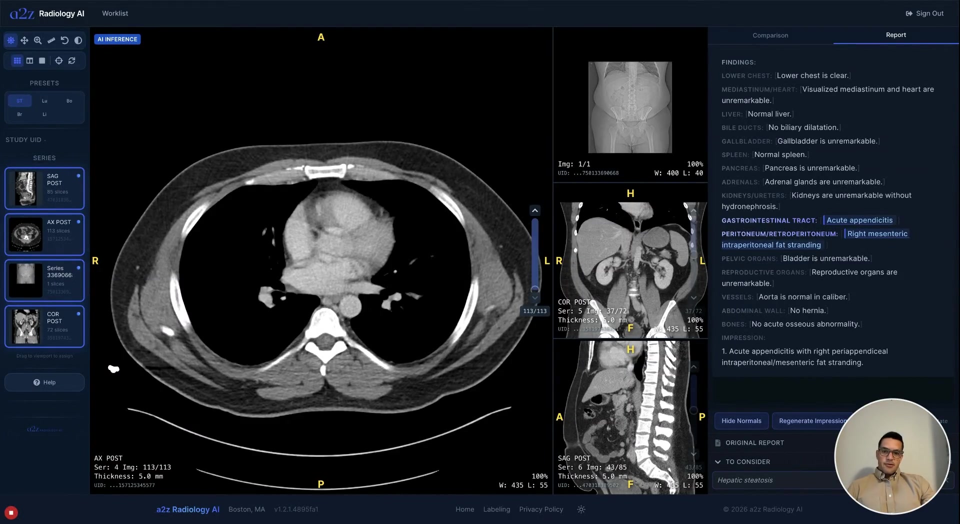 Evidence | a2z Radiology AI